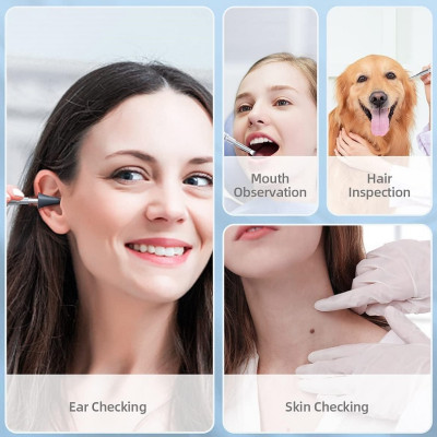 ROGTZ - Camera Nội Soi Tai Mũi Họng C02 Lens 3.9mm Màn Hình 4.5 Inch LCD Kỹ Thuật Số Phân Giải 1920*1080 6LED Hỗ Trợ Chụp Nhanh Và Quay Video 1080P Pin 2500mAh 4-5h Chống Nước IP67 Tai Mũi Họng Cơ Thể Bên Trong  - Hàng Chính Hãng