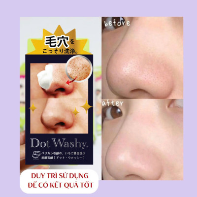 Xà Phòng Rửa Mặt ,Làm Sạch Bã Nhờn Và Mụn Vùng Cánh Mũi Pelican Dot Washy (75G)