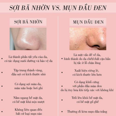 Xà Phòng Rửa Mặt ,Làm Sạch Bã Nhờn Và Mụn Vùng Cánh Mũi Pelican Dot Washy (75G)