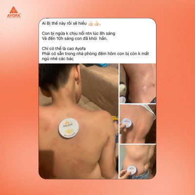 Cao Xoa Bóp Massage Thảo Dược Giúp Phục Hồi Và Làm Dịu Nhanh Chóng Ayofa Relax Hương Gừng 20G