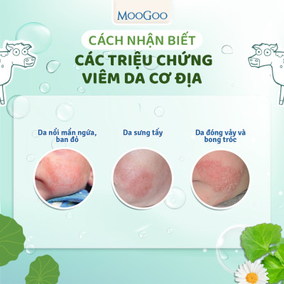 Kem bôi viêm da cơ địa, vảy nến, chàm sữa em bé, chiết xuất rau má MooGoo
