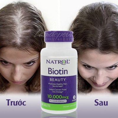 Hỗ trợ mọc tóc Natrol Biotin Beauty giúp tóc mọc nhanh dài, dày hơn, làn da rạng rỡ và móng tay chắc khỏe - OZ Slim Store