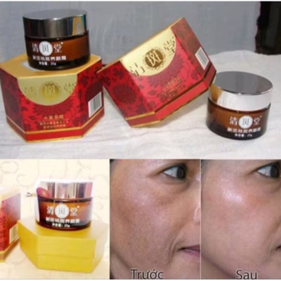 HỘP KEM TRỊ HẾT NÁM TÀN NHANG TỪ NHẬT BẢN HÀNG XỊN CHUẨN CHẤT LƯỢNG