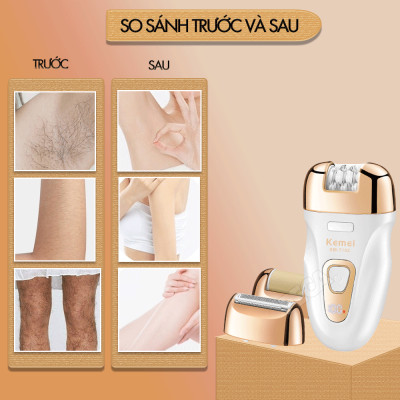 Máy tẩy lông đa năng 3in1 Kemei KM-7102 gồm 3 đầu thay thế chuyên dụng nhổ lông, cạo lông, chà gót chân sử dụng toàn thân - Chính hãng